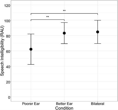 Interaural speech asymmetry predicts bilateral speech intelligibility but not listening effort in adults with bilateral cochlear implants